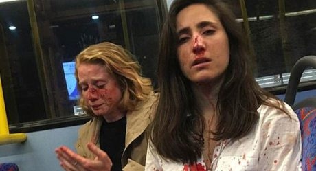 Golpean brutalmente a azafata y su novia en autobús de Londres, por no querer besarse