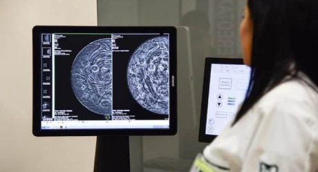 ES OFICIAL: Cofepris advierte que los implantes mamarios de Allergan pueden causar cáncer