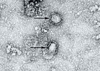 Así se ve el coronavirus desde el microscopio