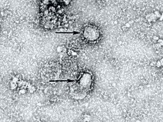 Así se ve el coronavirus desde el microscopio