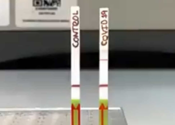 Científicos-crean-prueba-para-detectar-Covid-19-en-minutos