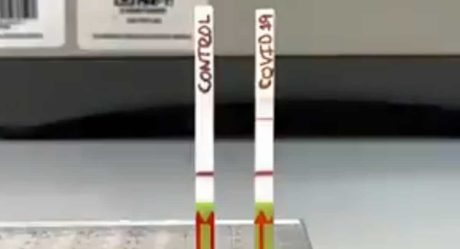 VIDEO: Científicos crean prueba para detectar Covid-19 en minutos