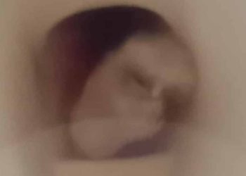 Hallan-feto-en-inodoro-de-parque