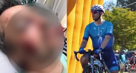 Automovilista no respetó distancia y atropelló a ciclista; está grave