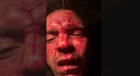 VIDEO: Golpean brutalmente a hijo de Lupita D'Alessio