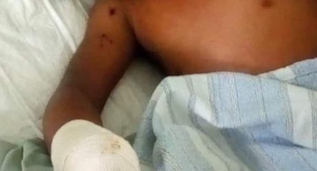 Niño pierde una mano tras explosión de pirotecnia