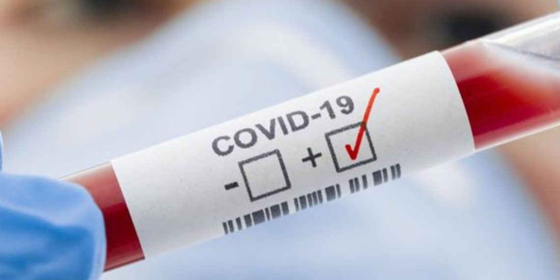 DOCTORA DA POSITIVO A COVID-19 ESTANDO VACUNADA