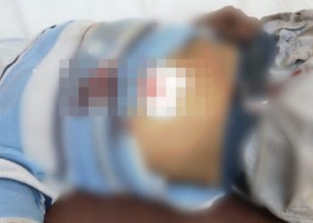 PONE RESISTENCIA EN ASALTO Y LO LESIONAN