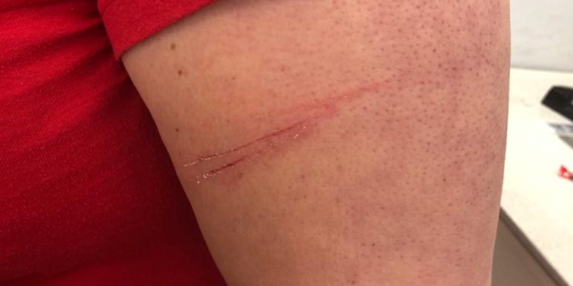 LA AMAGAN CON CUCHILLO A LA ENTRADA DE UN OXXO