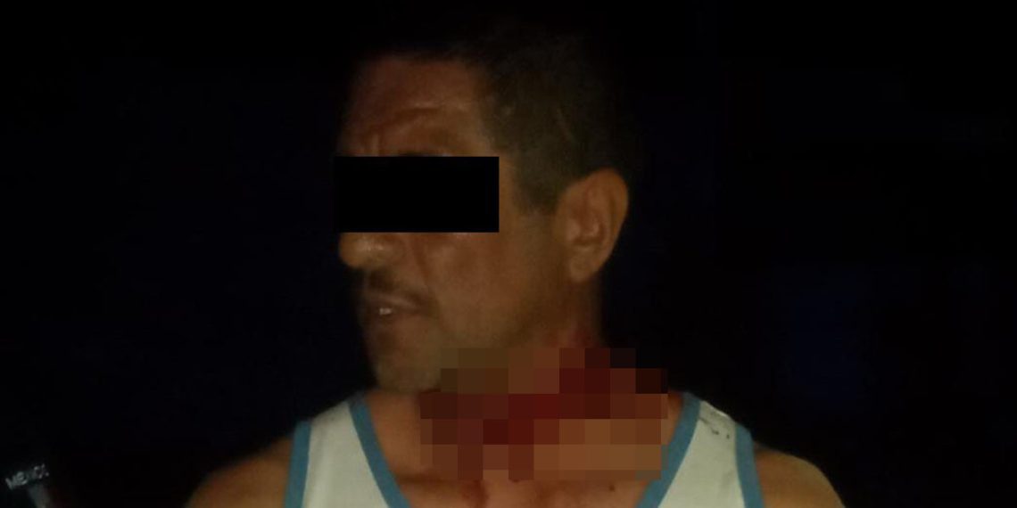 LESIONA A SU PAREJA CON UN CUCHILLO