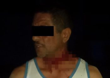 LESIONA A SU PAREJA CON UN CUCHILLO