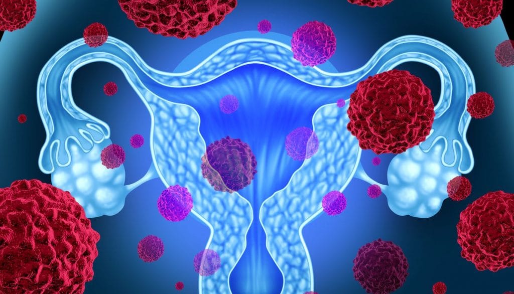 secretaria-de-salud-invita-a-mujeres-a-prevenir-cancer-de-ovario