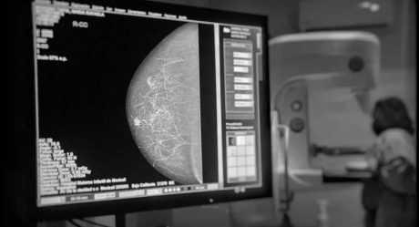 Jurisdicción de Salud promueve mastografías gratuitas todo el año