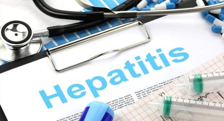Clúster Médico advierte sobre Hepatitis Aguda Infantil