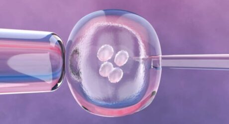 Fertilización in vitro método indicado para mujeres con daños en trompas de Falopio